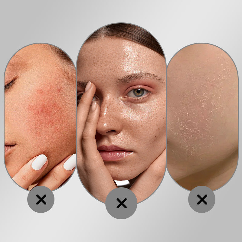 🔥Hot Sale 50% OFF🔥Crème visage blanchissante et hydratante pour éliminer les taches de rousseur