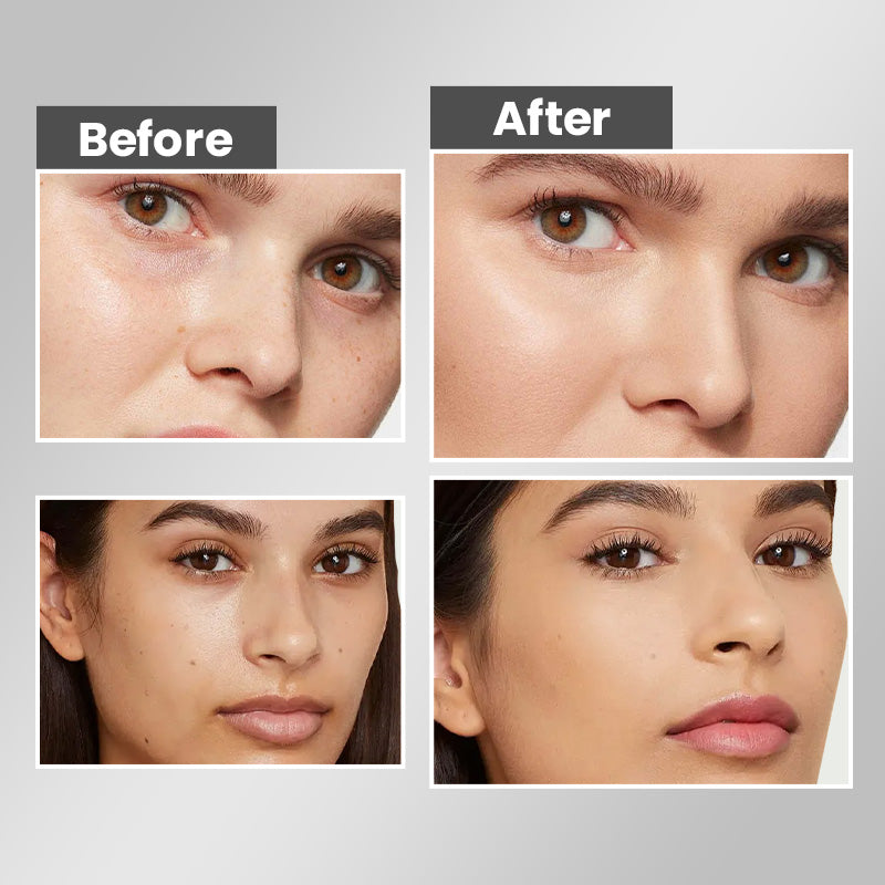 🔥Hot Sale 50% OFF🔥Crème visage blanchissante et hydratante pour éliminer les taches de rousseur